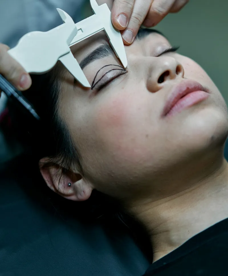 A surgeon's hands measuring above a patient's closed eye with a caliper, fine planning lines drawn on the lid